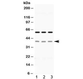 Western blot testing of human 1) HeLa, 2) A549 and 3) PANC-1 lysate with EpCAM antibody at 0.5ug/ml. Expected molecualr weight: 35/40-42 kDa (unmodified/glycosylated).