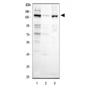 Western blot testing of human 1) HeLa, 2) A431 and 3) SiHa cell lysate with CSB antibody at 0.5ug/ml. Predicted/observed molecular weight: ~168 kDa.