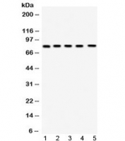 Western blot testing of 1) rat testis, 2) rat ovary, 3) mouse testis, 4) mouse ovary and 5) human HeLa lysate with FSH Receptor antibody at 0.5ug/ml. Predicted/observed molecular weight: ~78 kDa.