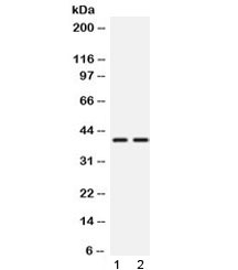 Western blot testing of 1) rat testis and 2) mouse testis lysate with TXNL2 antibody at 0.5ug/ml. Expected molecular weight: ~40 kDa.