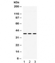 Western blot testing of 1) rat liver, 2) mouse heart and 3) human HeLa lysate with GNB1 antibody at 0.5ug/ml. Predicted/observed molecular weight: ~37 kDa.