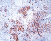 IHC testing of FFPE human placental tissue with GNB1 antibody at 1ug/ml. HIER: steam section in pH6 citrate buffer for 20 min.