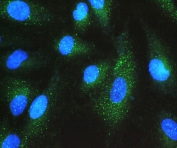 IF/ICC staining of FFPE human A549 cells with GNB1 antibody (green) at 2ug/ml and DAPI nuclear stain (blue). HIER: steam section in pH6 citrate buffer for 20 min.