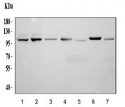 Western blot testing of 1) human HeLa, 2) human PANC1, 3) human A549, 4) rat heart, 5) rat kidney, 6) mouse heart and 7) mouse kidney tissue lysate with HLTF antibody at 0.5ug/ml. Predicted molecular weight: ~114 kDa.