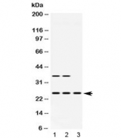 Western blot testing of 1) rat brain, 2) mouse brain and 3) human HeLa lysate with HPRT antibody at 0.5ug/ml. Predicted/observed molecular weight: ~24 kDa.