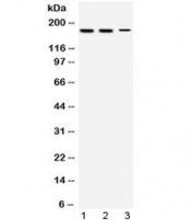 Western blot testing of 1) rat testis, 2) mouse testis and 3) human HepG2 lysate with KDM5B antibody at 0.5ug/ml. Predicted/observed molecular weight: ~176 kDa.