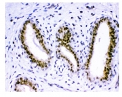 Western blot testing of 1) rat testis, 2) mouse testis and 3) human HepG2 lysate with KDM5B antibody at 0.5ug/ml. Predicted/observed molecular weight: ~176 kDa.