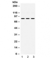 Western blot testing of 1) rat heart, 2) mouse NIH 3T3 and 3) human HeLa lysate with KRIT1 antibody at 0.5ug/ml. Predicted/observed molecular weight: ~84 kDa.