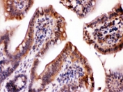 IHC testing of FFPE mouse intestine with LDHA antibody at 1ug/ml.  HIER: steam section in pH6 citrate buffer for 20 min.