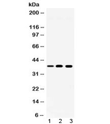 Western blot testing of 1) rat spleen, 2) mouse ANA-1 and 3) human Jurkat lysate with LDHA antibody at 0.5ug/ml. Predicted/observed molecular weight ~36 kDa.