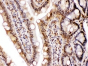 IHC testing of FFPE rat intestine with LDHA antibody at 1ug/ml.  HIER: steam section in pH6 citrate buffer for 20 min.