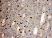 IHC testing of FFPE human brain with LDHB antibody at 1ug/ml.  HIER: steam section in pH6 citrate buffer for 20 min.