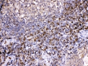 IHC testing of FFPE human tonsil with LDHB antibody at 1ug/ml.  HIER: steam section in pH6 citrate buffer for 20 min.