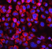 Immunofluorescent staining of human A431 cells with LDHB antibody (red) and DAPI nuclear stain (blue).