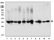 Western blot testing of 1) human HeLa, 2) human placenta, 3) human PC-3, 4) monkey COS-7, 5) human HEK293, 6) human A549, 7) monkey kidney, 8) rat kidney, 9) rat heart, 10) mouse kidney and 11) mouse heart lysate with LDHB antibody at 0.5ug/ml. Predicted molecular weight ~36 kDa.