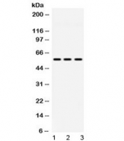 Western blot testing of 1) rat lung, 2) mouse spleen and 3) human MCF7 lysate with MPP1 antibody at 0.5ug/ml.  Predicted/observed molecular weight 52-55 kDa.
