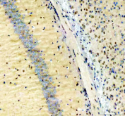 IHC staining of FFPE mouse brain tissue with NFIA antibody, HRP-secondary and DAB substrate. HIER: boil tissue sections in pH8 EDTA for 20 min and allow to cool before testing.