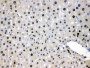 IHC testing of FFPE mouse liver with NFIA antibody at 1ug/ml.  HIER: steam section in pH6 citrate buffer for 20 min.