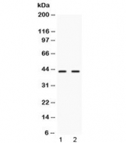 Western blot testing of 1) rat liver and 2) human HeLa lysate with NR2F6 antibody at 0.5ug/ml.  Predicted/observed molecular weight ~43 kDa.