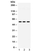 Western blot testing of 1) rat testis, 2) mouse testis and 3) human HeLa lysate with PIAS4 antibody at 0.5ug/ml.  Predicted/observed molecular weight ~57 kDa.