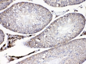 IHC testing of FFPE mouse testis with ADRP antibody at 1ug/ml.  HIER: steam section in pH6 citrate buffer for 20 min.