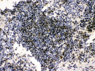 IHC testing of FFPE mouse spleen with PML antibody at 1ug/ml. HIER: steam section in pH6 citrate buffer for 20