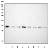 Western blot testing of 1) human MCF7, 2) human PC-3, 3) human HepG2, 4) human Jurkat, 5) rat brain, 6) rat liver, 7) mouse brain and 8) mouse liver tissue lysate with PSMA1 antibody. Predicted molecular weight ~30 kDa.