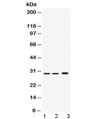 Western blot testing of 1) rat testis, 2) mouse spleen and 3) human HepG2 lysate with PSMA1 antibody at 0.5ug/ml. Predicted/observed molecular weight ~30 kDa.~