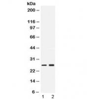 Western blot testing of 1) rat testis and 2) human MCF7 lysate with PSMA2 antibody at 0.5ug/ml. Predicted/observed molecular weight ~26 kDa.