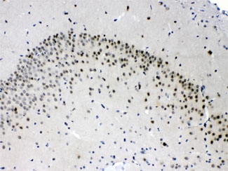 IHC testing of FFPE rat brain with PSMA3 antibody at 1ug/ml. HIER: steam section in pH6 citrate buffer for 20 min.