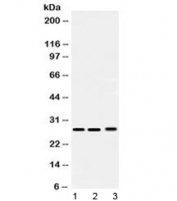Western blot testing of 1) rat testis, 2) mouse lung and 3) human 293T lysate with PSMA3 antibody at 0.5ug/ml. Predicted/observed molecular weight ~28 kDa.