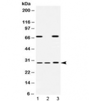 Western blot testing of 1) rat liver, 2) mouse spleen and 3) human HeLa lysate with PSMA4 antibody at 0.5ug/ml. Predicted/observed molecular weight ~29 kDa.
