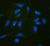 IF/ICC staining of FFPE human U-2 OS cells with RPL19 antibody (green) at 2ug/ml and DAPI nuclear stain (blue). HIER: steam section in pH6 citrate buffer for 20 min.