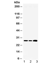 Western blot testing of 1) rat liver, 2) mouse HEPA and 3) human HepG2 lysate with RPL19 antibody at 0.5ug/ml. Expected molecular weight: 23-28 kDa.