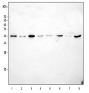 Western blot testing of 1) human MCF7, 2) human A2780, 3) human 293T, 4) human Jurkat, 5) rat brain, 6) rat liver, 7) mouse brain and 8) mouse liver tissue lysate with RPL19 antibody at 0.5ug/ml. Expected molecular weight: 23-28 kDa.