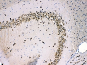 IHC testing of FFPE mouse brain with MPS1 antibody at 1ug/ml. HIER: steam section in pH6 citrate buffer for 20 min.