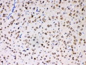 IHC testing of FFPE rat brain with MPS1 antibody at 1ug/ml. HIER: steam section in pH6 citrate buffer for 20 min.