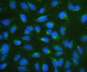 Immunofluorescent staining of FFPE human U-2 OS cells with RPSA antibody (green) and DAPI nuclear stain (blue). HIER: boil tissue sections in pH6, 10mM citrate buffer, for 20 min and allow to cool before testing.
