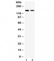 Western blot testing of human 1) HeLa and 2) MCF7 cell lysate with SAFB antibody at 0.5ug/ml. Predicted molecular weight: ~103 kDa but routinley observed at ~150 kDa.