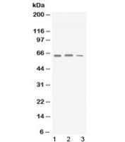 Western blot testing of 1) rat brain, 2) mouse brain and 3) human U87 lysate with Synapsin II antibody at 0.5ug/ml. Predicted molecular weight ~63 kDa.