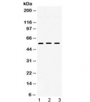 Western blot testing of 1) rat heart, 2) mouse liver and 3) human HeLa lysate with TGF beta receptor I antibody at 0.5ug/ml. Predicted/observed molecular weight ~55 kDa.