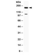 Western blot testing of human MCF7 cell lysate with TIAM1 antibody at 0.5ug/ml. Predicted/observed molecular weight ~178 kDa.