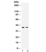 Western blot testing of human 1) HeLa and 2) SW620 cell lysate with HVEM antibody at 0.5ug/ml. Expected molecular weight: 30-38 kDa depending on glycosylation level.