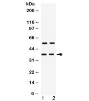 Western blot testing of human 1) HeLa and 2) MCF7 cell lysate with TREX2 antibody at 0.5ug/ml. Predicted molecular weight ~31/26 kDa (isoforms 1/2), observed here at ~37 kDa.