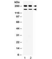 Western blot testing of 1) rat thymus and 2) human placenta lysate with WRN antibody at 0.5ug/ml. Observed molecular weight: ~162 and 200 kDa.