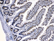 IHC testing of FFPE rat intestine tissue with CASP8 antibody at 1ug/ml. HIER: steam section in pH6 citrate buffer for 20 min.