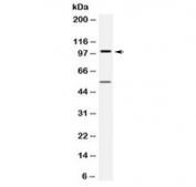 Western blot testing of human HepG2 cell lysate with FGFR1 antibody at 0.5ug/ml. Predicted molecular weight: 75-160 kDa depending on glycosylation level