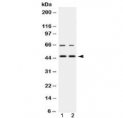 Western blot testing of 1) rat testis and 2) human HeLa lysate with MPI antibody at 0.5ug/ml. Predicted molecular weight ~47 kDa.