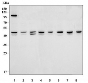 Western blot testing of 1) human HeLa, 2) human Caco-2, 3) human HEK293, 4) rat brain, 5) rat lung, 6) rat heart, 7) mouse brain and 8) mouse lung tissue lysate with MPI antibody at 0.5ug/ml. Predicted molecular weight ~47 kDa.