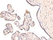 IHC staining of FFPE human placental tissue with KCNQ1 antibody. HIER: boil tissue sections in pH8 EDTA for 20 min and allow to cool before testing.
